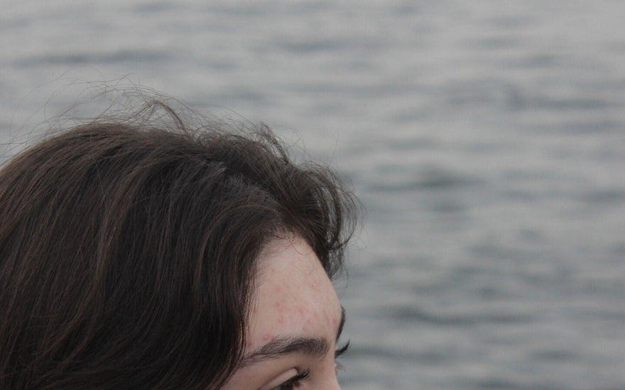 Junge Frau am Wasser – Akne verstehen