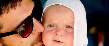 Vater mit Baby – Baby-Ekzem erkennen und pflegen